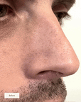 Overnight Pore Rescue Nose Patches