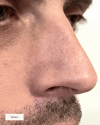 Overnight Pore Rescue Nose Patches