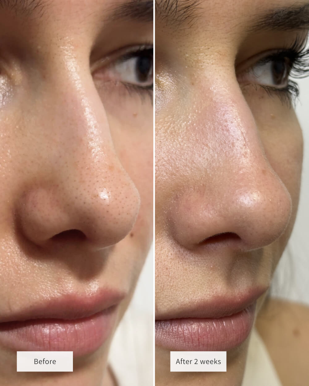 Overnight Pore Rescue Nose Patches