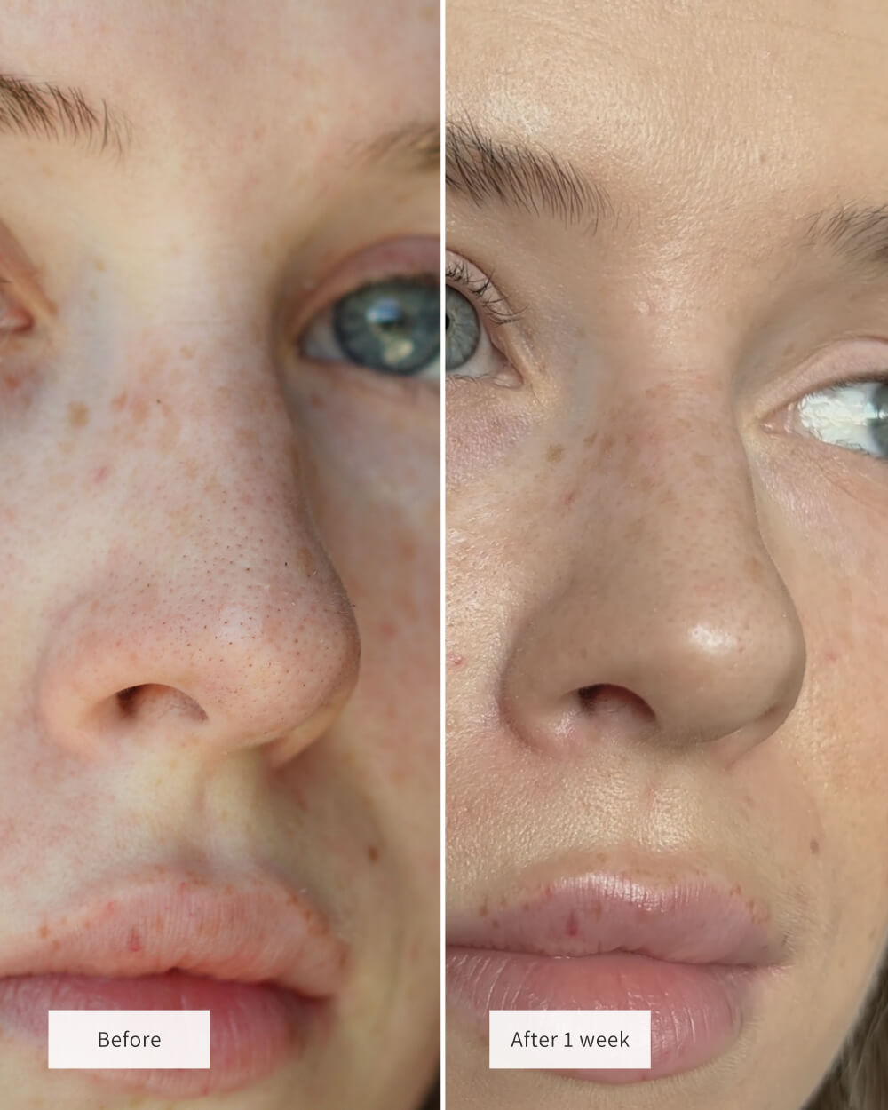 Overnight Pore Rescue Nose Patches